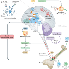 Cervello_Ipertensione