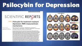 PsylocibinDepressione